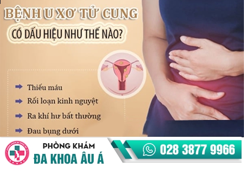 u xơ tử cung gây ra tình trạng chảy máu âm đạo bất thường